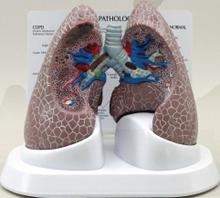 Diseased Lung Pharmaceutical and Anatomical Model Gifts